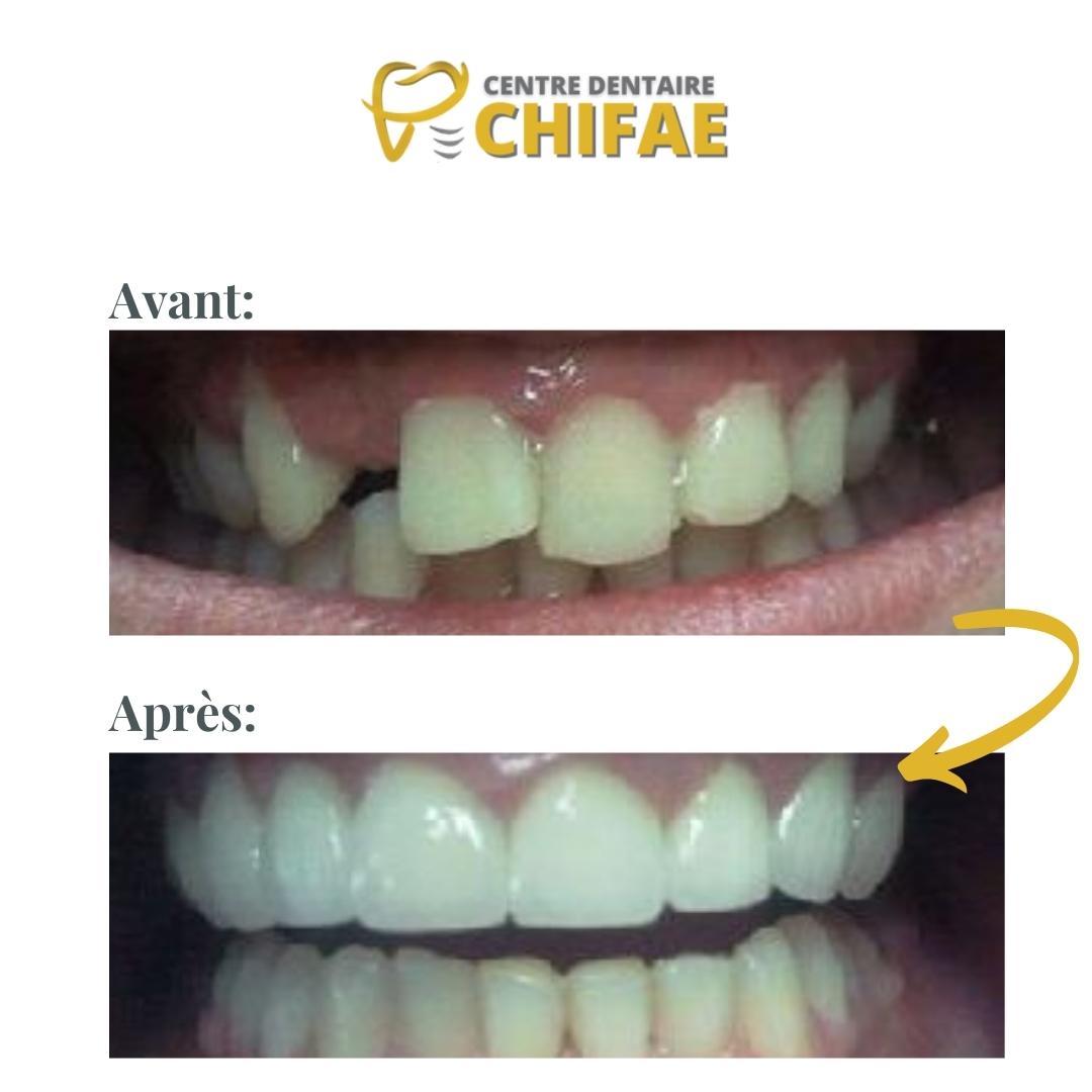 2 orthodontie Tanger