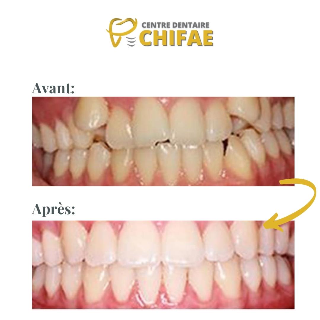 5 orthodontie Tanger